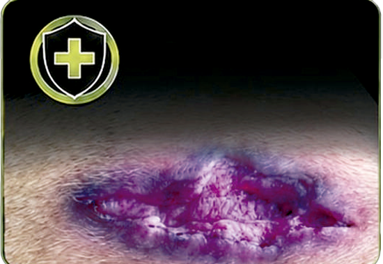 Efecto cicatrizante protector de heridas